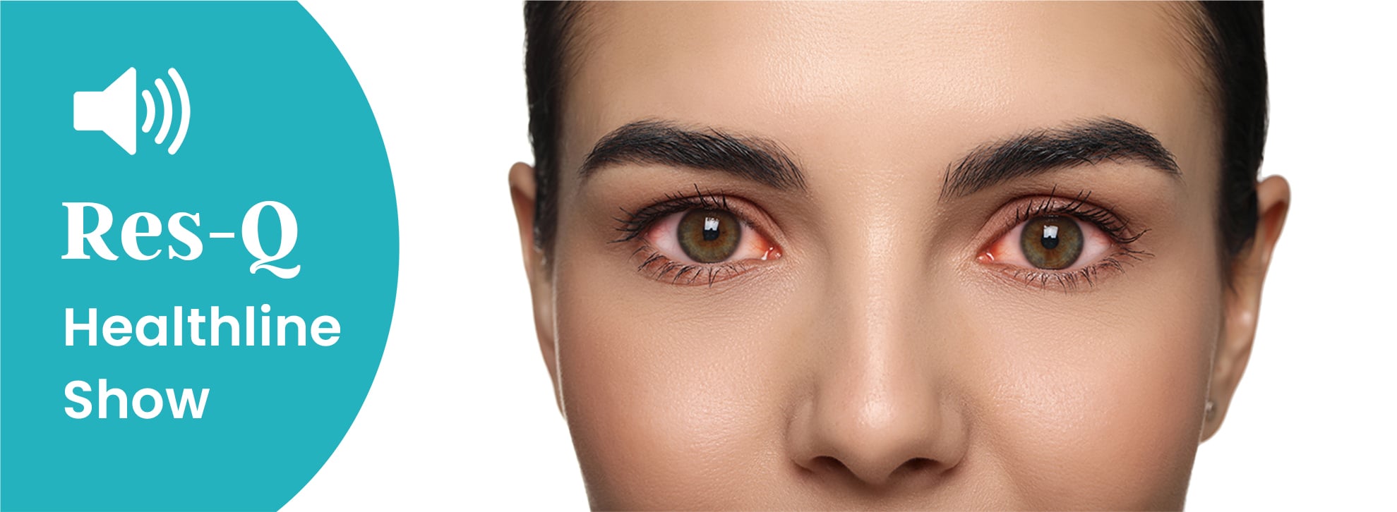A women looks forward with red, irritated eyes
