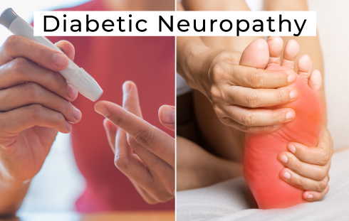 Neuropathy: The Importance of Healthy Blood Sugar Levels 
