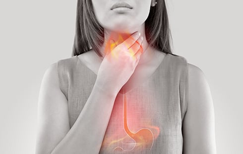 Explaining GERD: It’s Not Just Heartburn